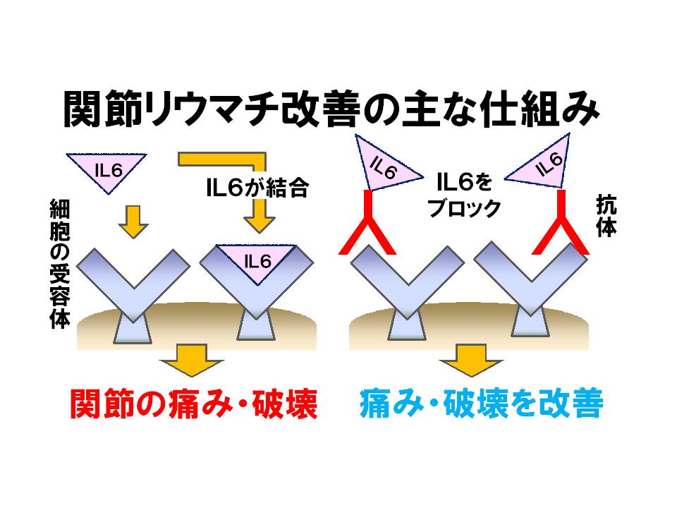 科学朝日 インターロイキン６の発見と免疫疾患 Collaborate With 朝日ニュースター 4月28日放送 論座 朝日 新聞社の言論サイト